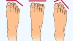 What is the shape of your feet ?