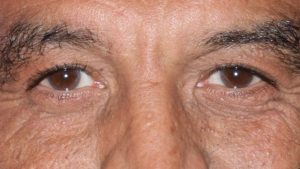 C'est l'un des plus grands acteurs comiques français et il a tourné 5 films et 2 séries avec Jonathan Cohen